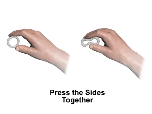 Verhütungsring zusammendrücken und dann leicht in die Vagina schieben